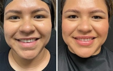 Mystique Medical Spa