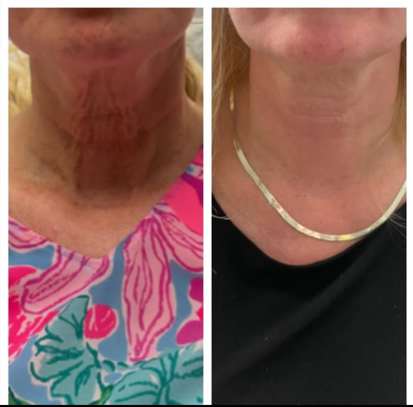 Destin Weight Loss & Wellness