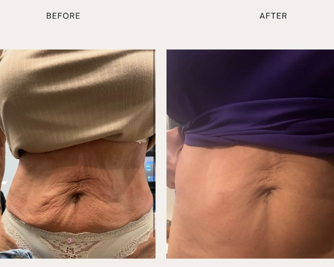 Destin Weight Loss & Wellness